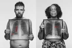 Black and white photos of a man and a woman holding an xray infront of their chests with their lung cancer shown in red